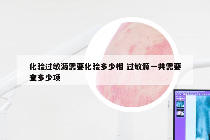 化验过敏源需要化验多少相 过敏源一共需要查多少项
