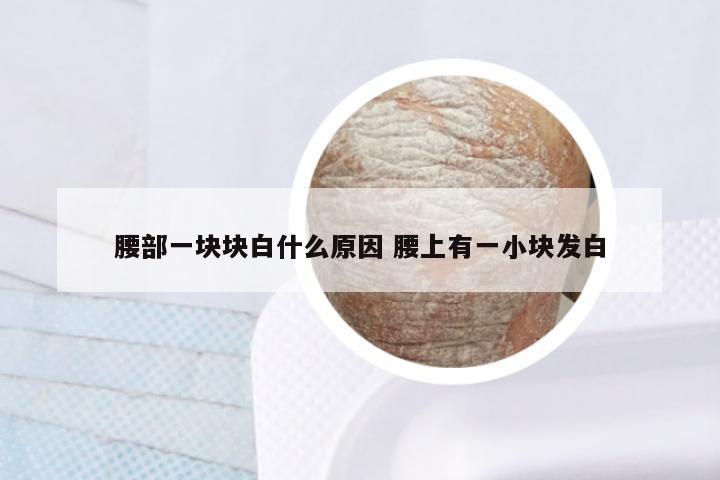腰部一块块白什么原因 腰上有一小块发白