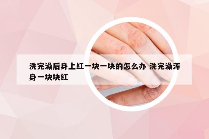 洗完澡后身上红一块一块的怎么办 洗完澡浑身一块块红