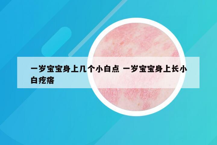一岁宝宝身上几个小白点 一岁宝宝身上长小白疙瘩