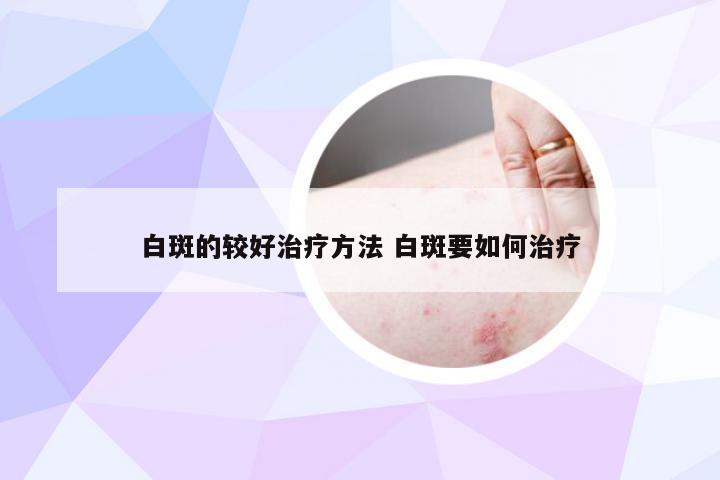白斑的较好治疗方法 白斑要如何治疗
