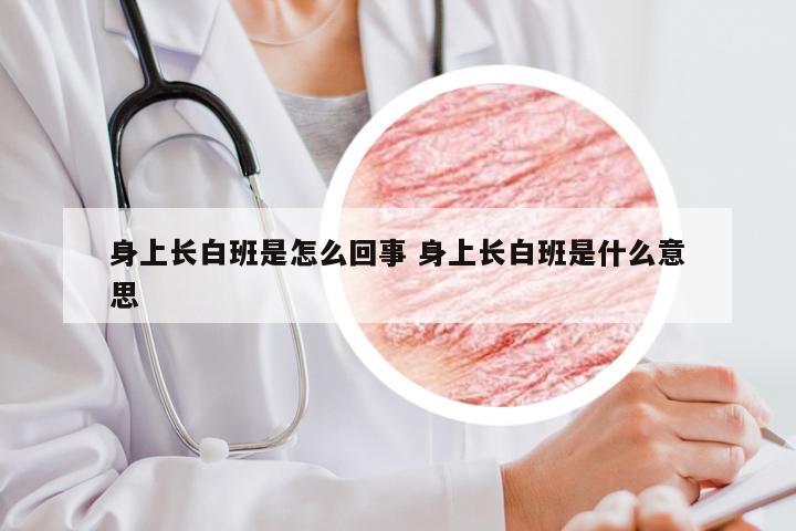 身上长白班是怎么回事 身上长白班是什么意思