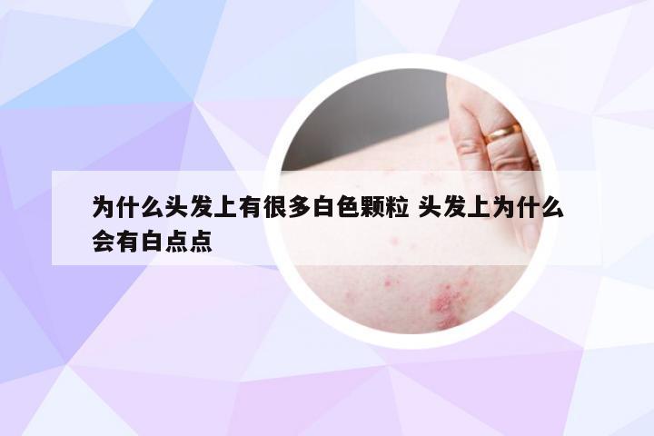 为什么头发上有很多白色颗粒 头发上为什么会有白点点