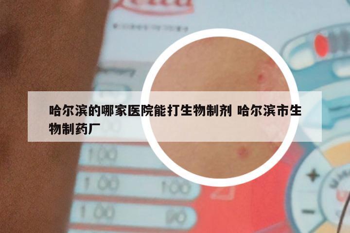 哈尔滨的哪家医院能打生物制剂 哈尔滨市生物制药厂