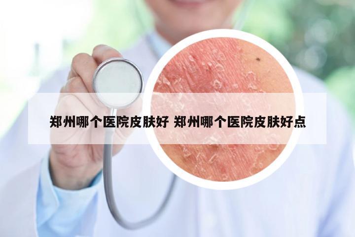 郑州哪个医院皮肤好 郑州哪个医院皮肤好点
