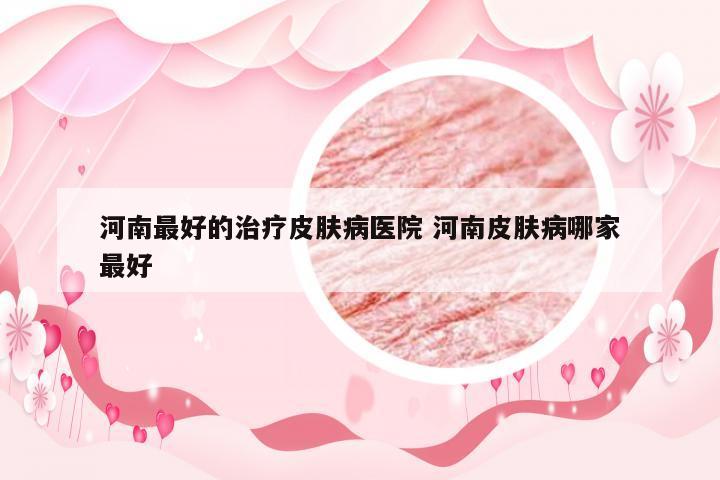 河南最好的治疗皮肤病医院 河南皮肤病哪家最好