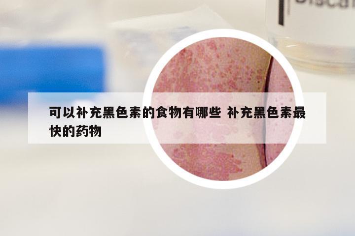 可以补充黑色素的食物有哪些 补充黑色素最快的药物