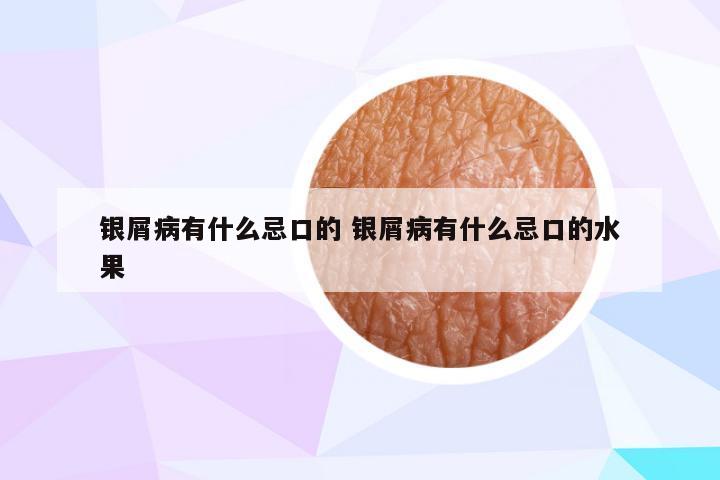 银屑病有什么忌口的 银屑病有什么忌口的水果