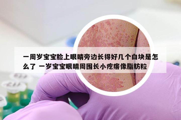 一周岁宝宝脸上眼睛旁边长得好几个白块是怎么了 一岁宝宝眼睛周围长小疙瘩像脂肪粒