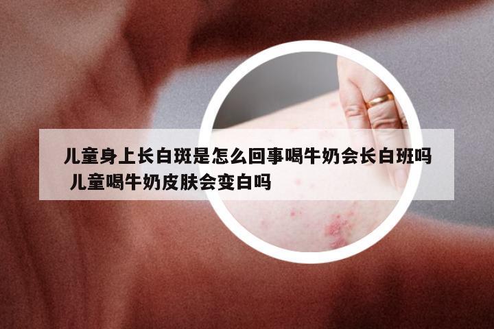 儿童身上长白斑是怎么回事喝牛奶会长白班吗 儿童喝牛奶皮肤会变白吗