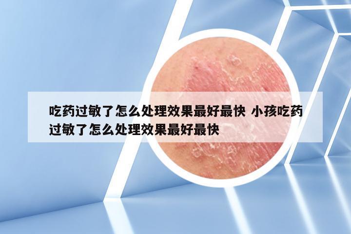 吃药过敏了怎么处理效果最好最快 小孩吃药过敏了怎么处理效果最好最快