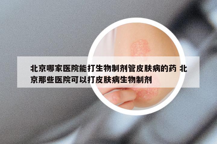 北京哪家医院能打生物制剂管皮肤病的药 北京那些医院可以打皮肤病生物制剂