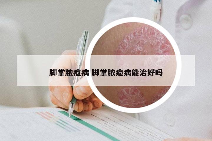 脚掌脓疱病 脚掌脓疱病能治好吗
