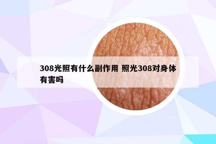 308光照有什么副作用 照光308对身体有害吗