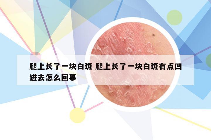 腿上长了一块白斑 腿上长了一块白斑有点凹进去怎么回事