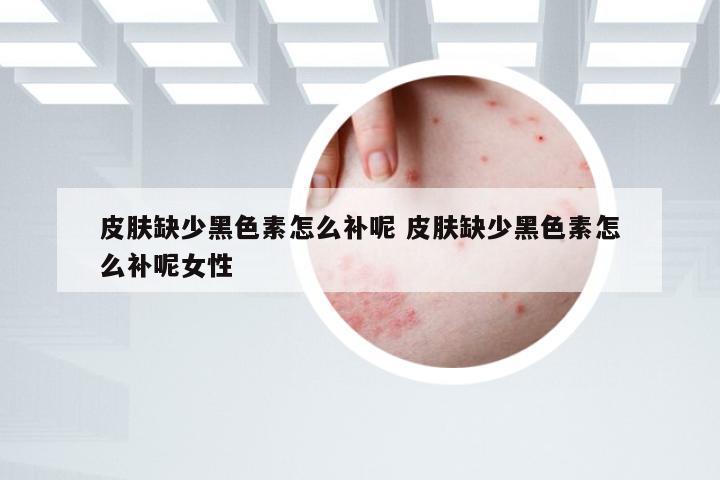 皮肤缺少黑色素怎么补呢 皮肤缺少黑色素怎么补呢女性