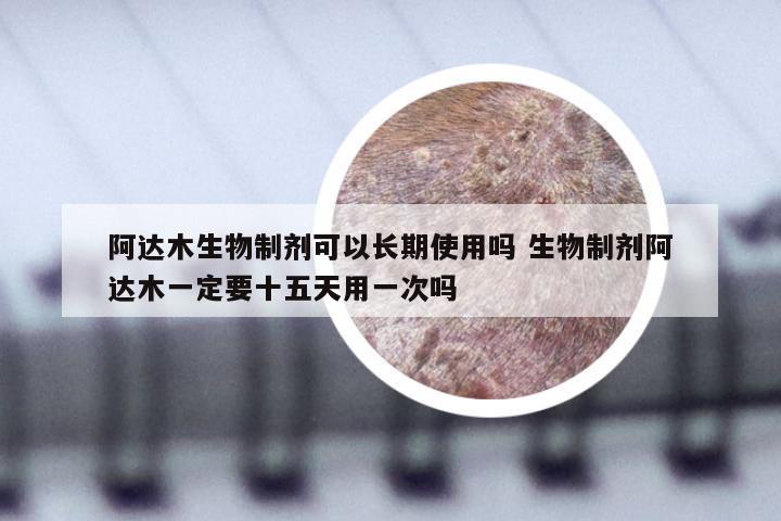 阿达木生物制剂可以长期使用吗 生物制剂阿达木一定要十五天用一次吗