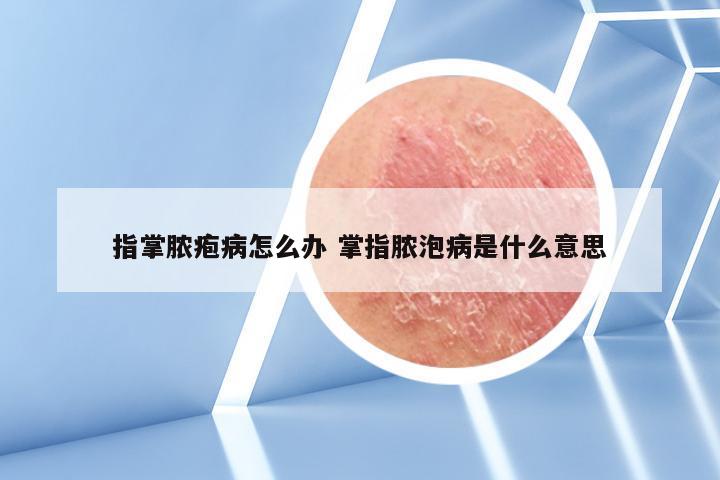 指掌脓疱病怎么办 掌指脓泡病是什么意思