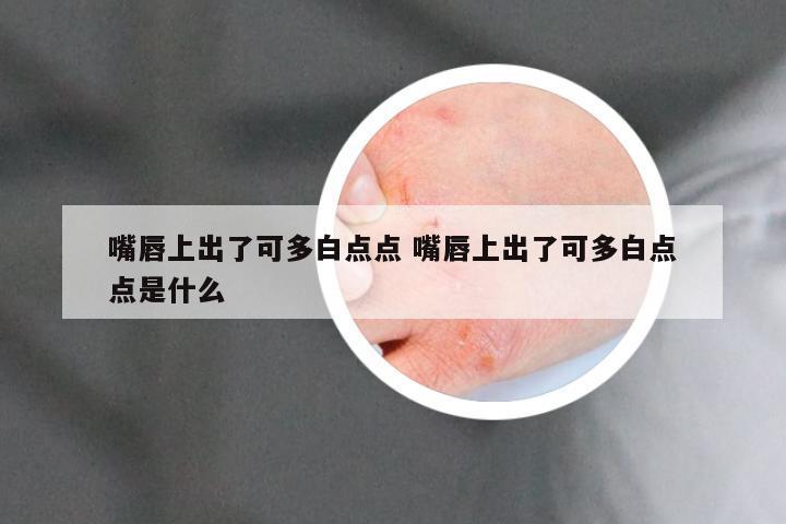 嘴唇上出了可多白点点 嘴唇上出了可多白点点是什么