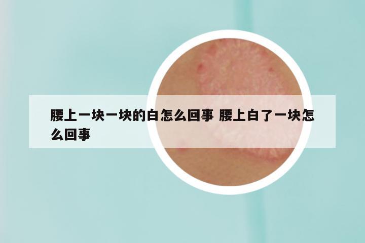 腰上一块一块的白怎么回事 腰上白了一块怎么回事