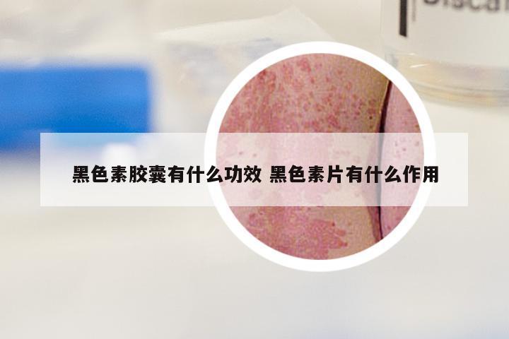 黑色素胶囊有什么功效 黑色素片有什么作用