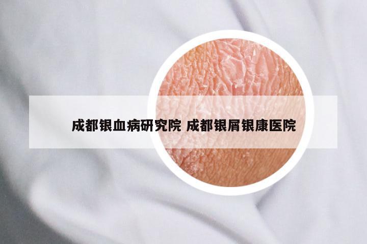 成都银血病研究院 成都银屑银康医院