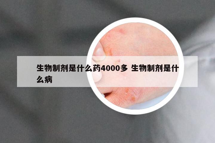 生物制剂是什么药4000多 生物制剂是什么病