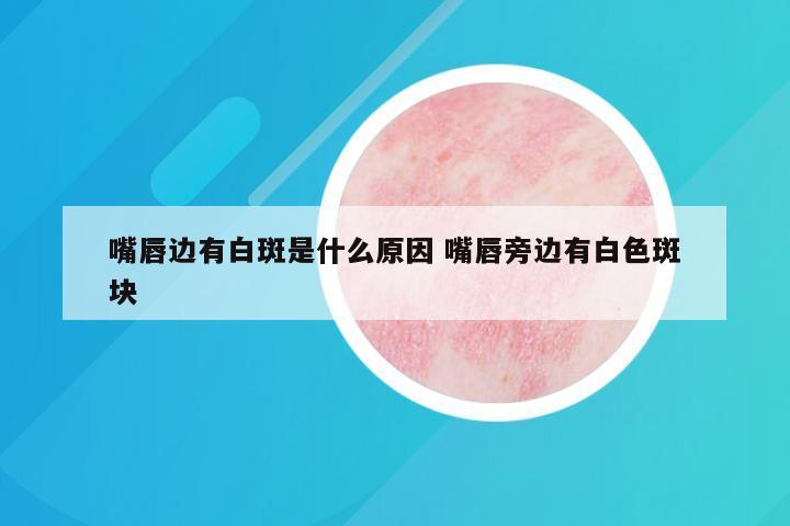 嘴唇边有白斑是什么原因 嘴唇旁边有白色斑块