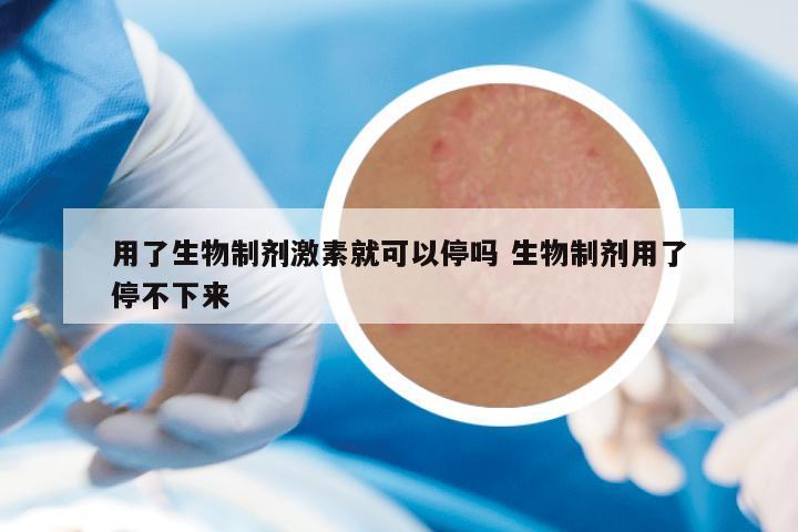用了生物制剂激素就可以停吗 生物制剂用了停不下来