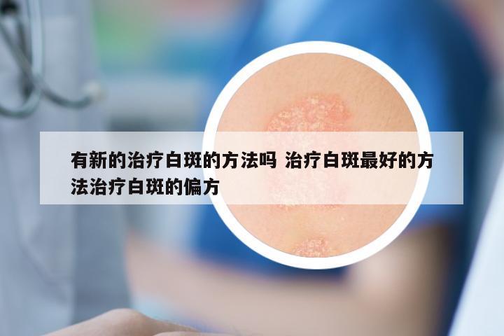 有新的治疗白斑的方法吗 治疗白斑最好的方法治疗白斑的偏方
