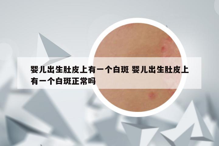 婴儿出生肚皮上有一个白斑 婴儿出生肚皮上有一个白斑正常吗