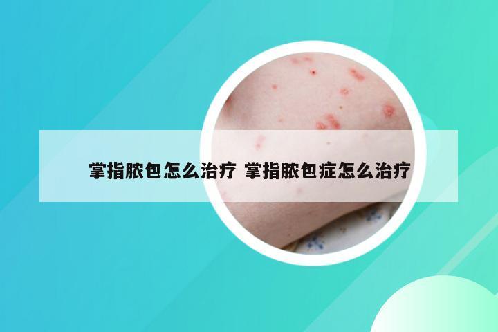 掌指脓包怎么治疗 掌指脓包症怎么治疗
