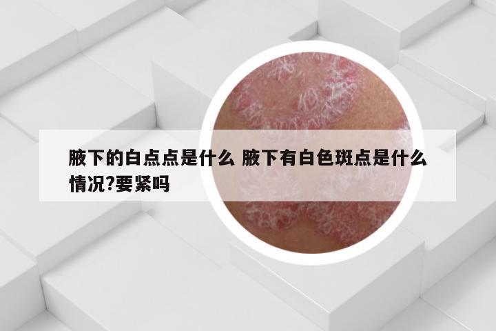 腋下的白点点是什么 腋下有白色斑点是什么情况?要紧吗