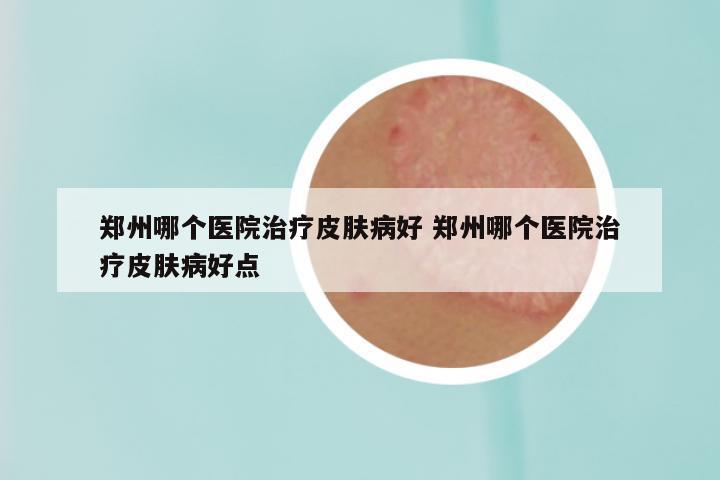 郑州哪个医院治疗皮肤病好 郑州哪个医院治疗皮肤病好点