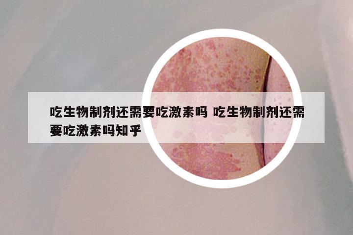 吃生物制剂还需要吃激素吗 吃生物制剂还需要吃激素吗知乎