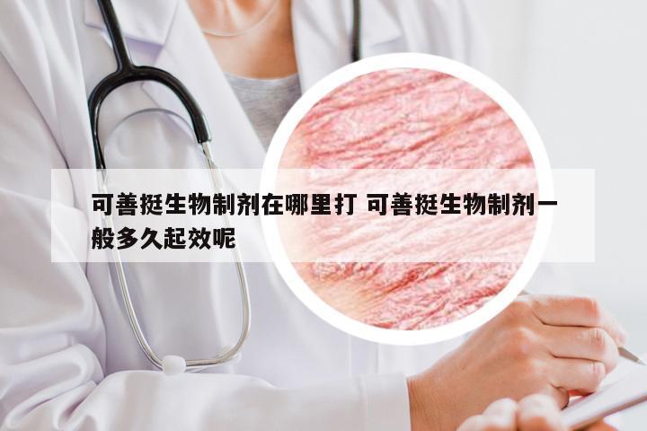 可善挺生物制剂在哪里打 可善挺生物制剂一般多久起效呢