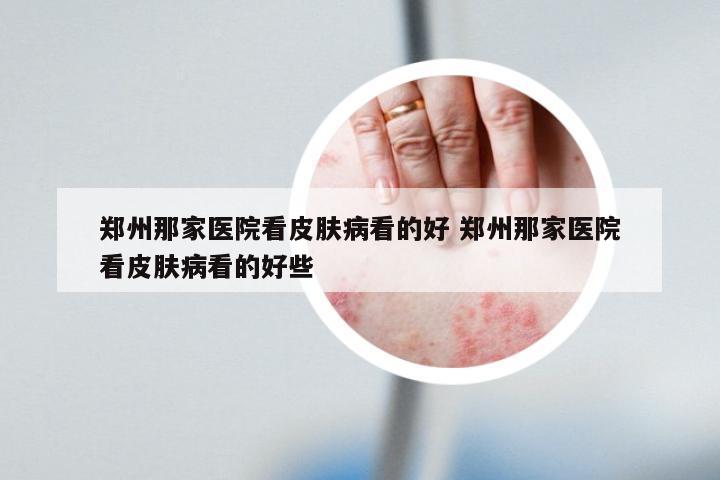 郑州那家医院看皮肤病看的好 郑州那家医院看皮肤病看的好些