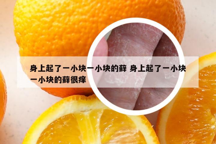 身上起了一小块一小块的藓 身上起了一小块一小块的藓很痒