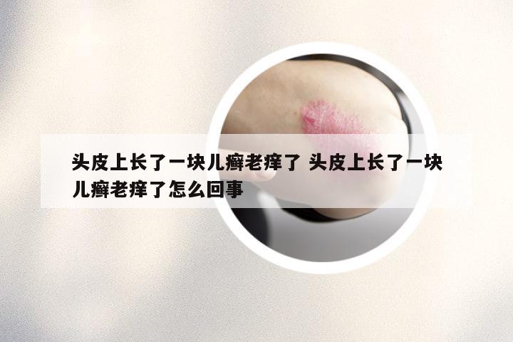 头皮上长了一块儿癣老痒了 头皮上长了一块儿癣老痒了怎么回事