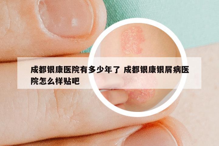 成都银康医院有多少年了 成都银康银屑病医院怎么样贴吧