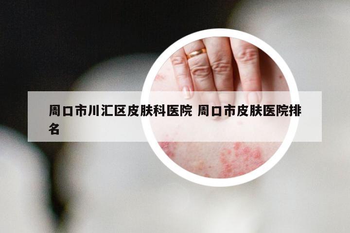 周口市川汇区皮肤科医院 周口市皮肤医院排名