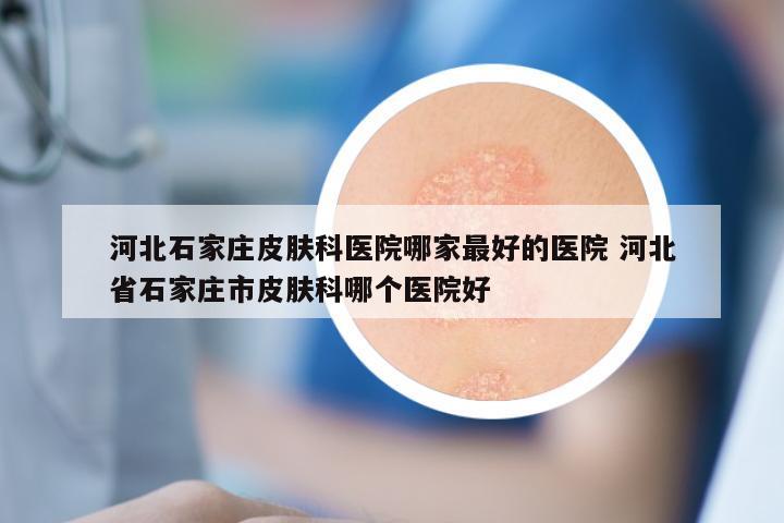 河北石家庄皮肤科医院哪家最好的医院 河北省石家庄市皮肤科哪个医院好