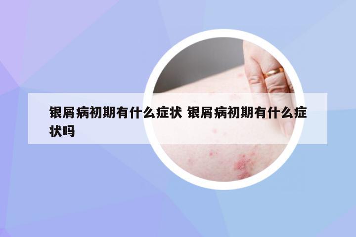 银屑病初期有什么症状 银屑病初期有什么症状吗