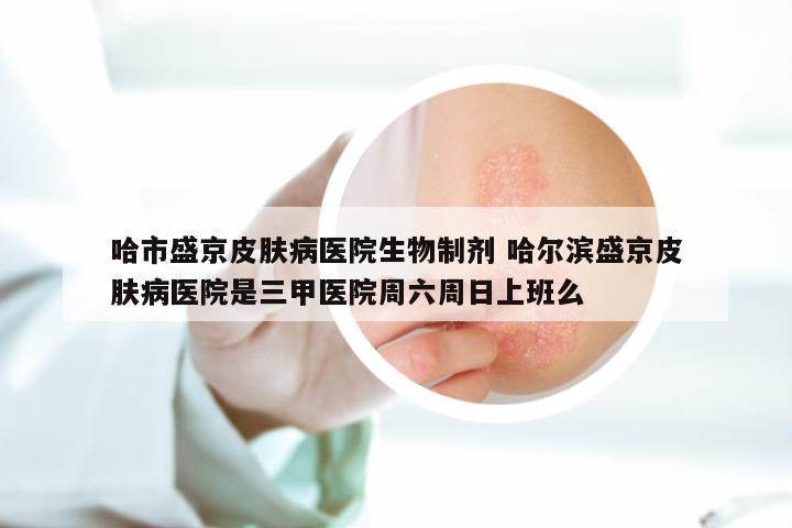 哈市盛京皮肤病医院生物制剂 哈尔滨盛京皮肤病医院是三甲医院周六周日上班么