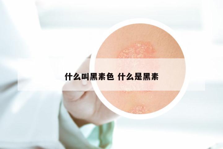 什么叫黑素色 什么是黑素