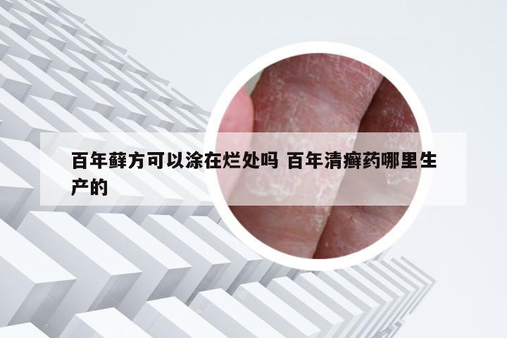 百年藓方可以涂在烂处吗 百年清癣药哪里生产的