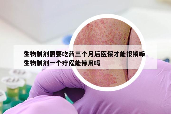 生物制剂需要吃药三个月后医保才能报销嘛 生物制剂一个疗程能停用吗
