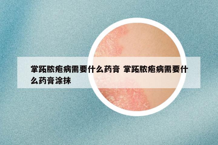 掌跖脓疱病需要什么药膏 掌跖脓疱病需要什么药膏涂抹