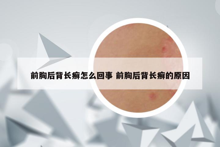 前胸后背长癣怎么回事 前胸后背长癣的原因