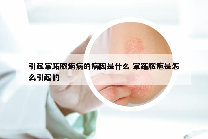 引起掌跖脓疱病的病因是什么 掌跖脓疱是怎么引起的